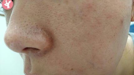 クレンジングバーム モイスト/CLAYGE/クレンジングバームを使ったクチコミ(1枚目)