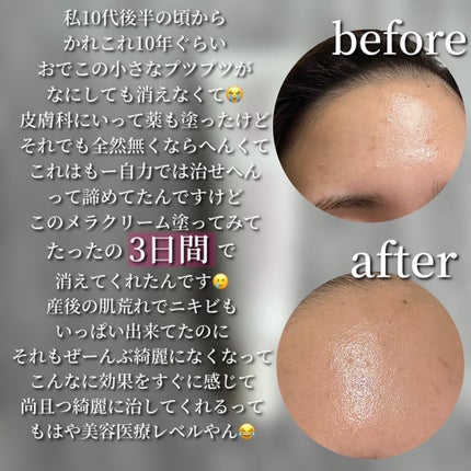CUREPAIR MELA CREAM /KOPHER/フェイスクリームを使ったクチコミ(3枚目)