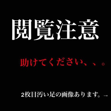 あろんあるふぁ on LIPS 「閲覧注意です。本当に助けてください。。私は生まれた時からアトピ..」（1枚目）