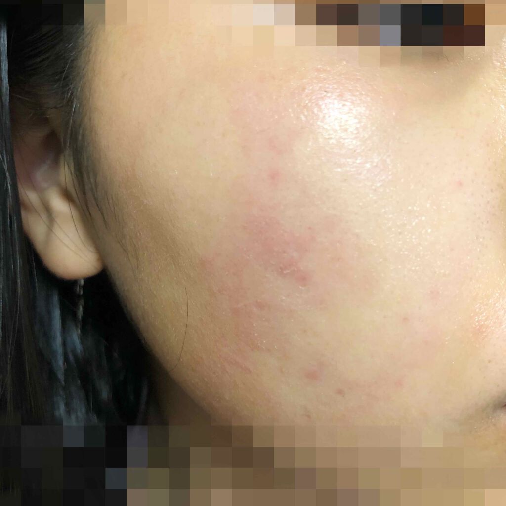 化粧水・敏感肌用・高保湿タイプ/無印良品/化粧水を使ったクチコミ（3枚目）