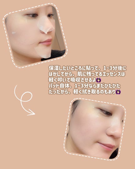 センテラ クイックカーミングパッド/SKIN1004/トナーパッドを使ったクチコミ(5枚目)