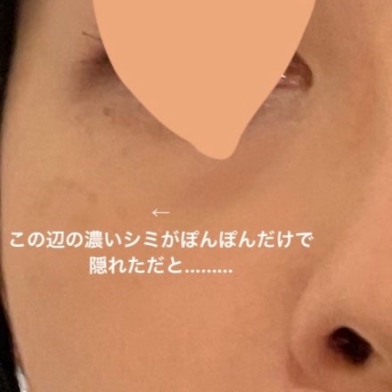 フローレス フィット/COVERMARK/クリーム・エマルジョンファンデーションを使ったクチコミ(1枚目)