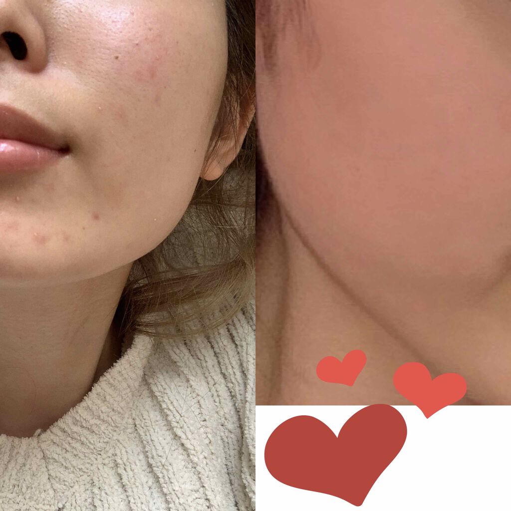 シルコット うるうるコットン/シルコット/コットンを使ったクチコミ(1枚目)