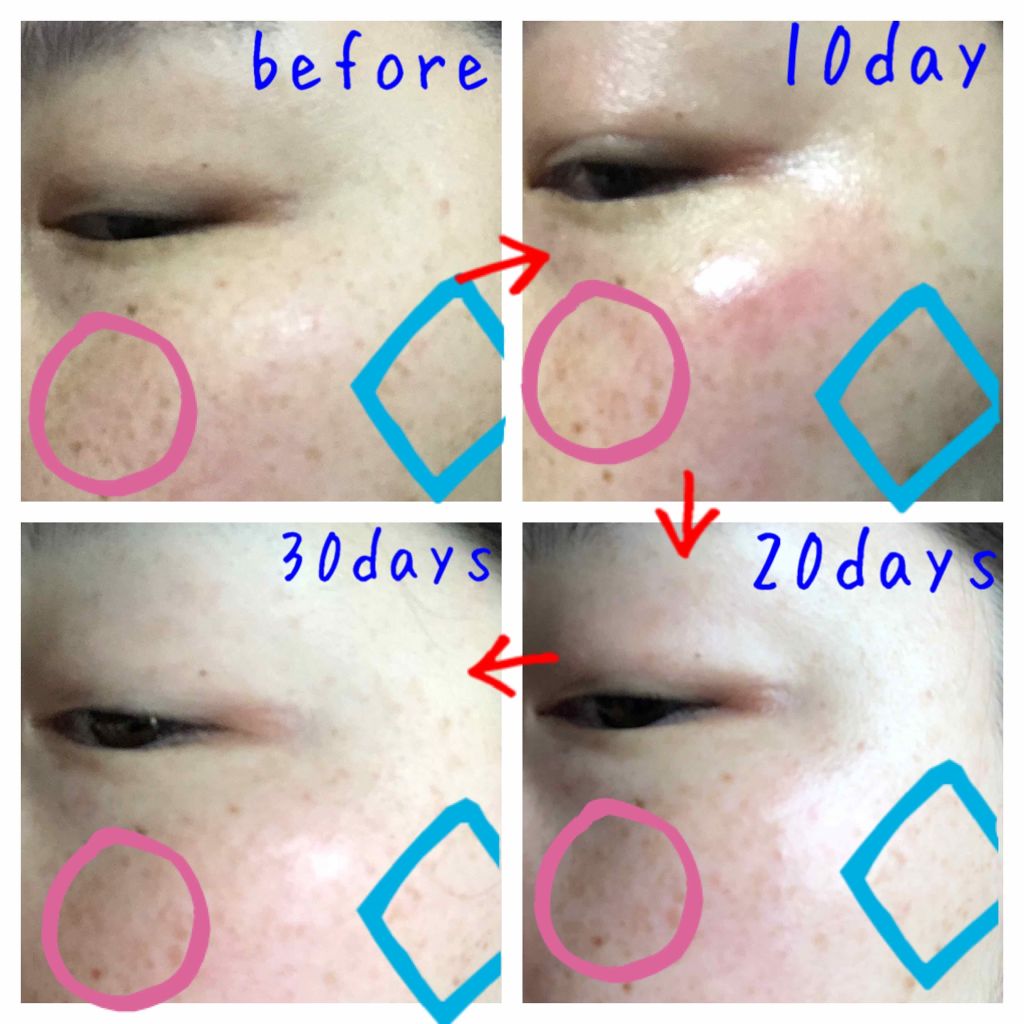 ホワイト 薬用ドットゼロ/リッツ/美容液を使ったクチコミ（3枚目）