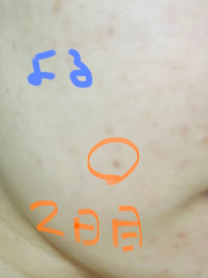 ザビタミンC23/IOPE/美容液を使ったクチコミ(2枚目)