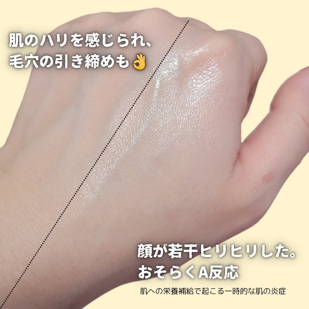 ビタペアC ビタレチ美容液/ネイチャーリパブリック/美容液を使ったクチコミ(4枚目)