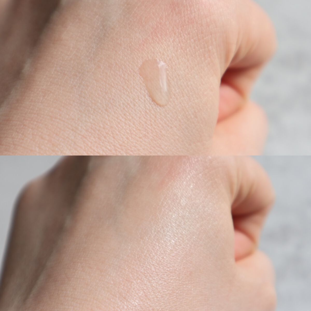 SBC ベビースキン パーフェクトリジェネレーション美容液/湘南美容/美容液を使ったクチコミ(2枚目)