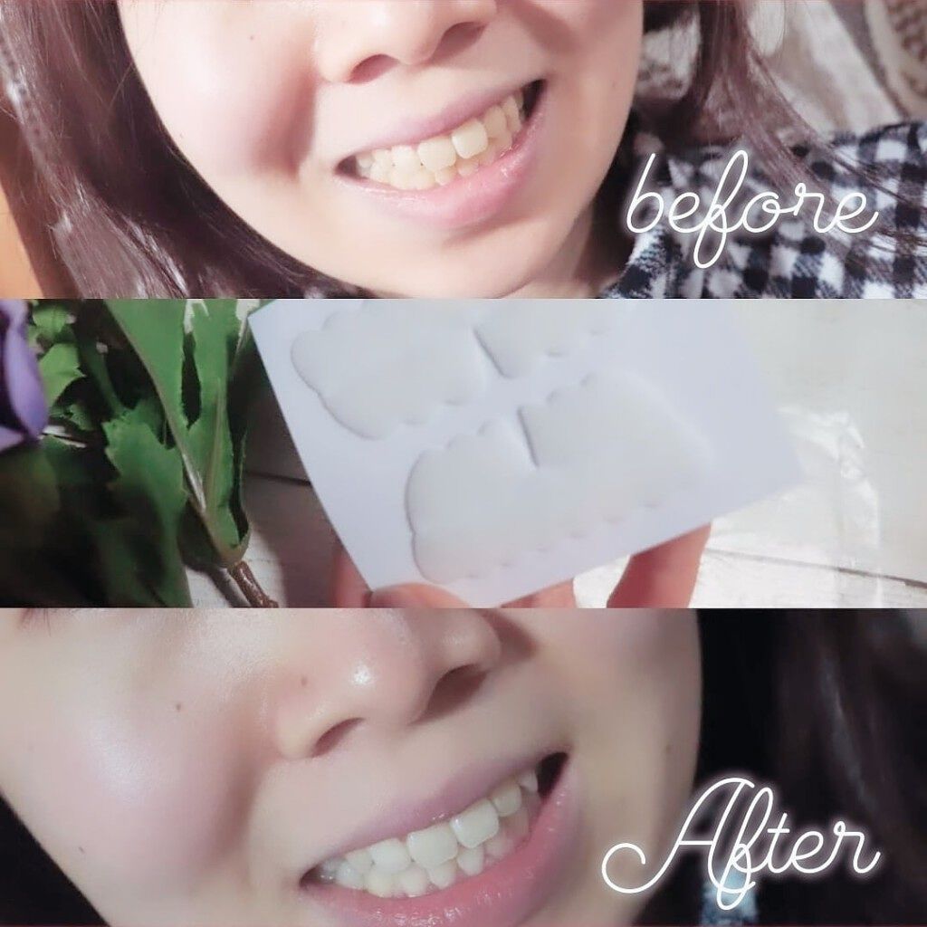 プレミアム ティースホワイトパック/Smile Cosmetique/その他オーラルケアを使ったクチコミ(2枚目)