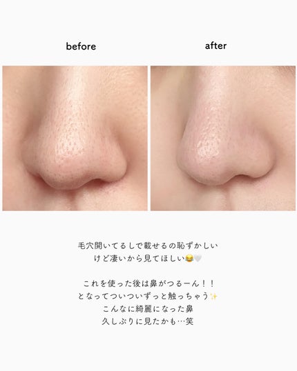 ナチュラルマイルドクリアノーズパック/ilso/シートマスク・パックを使ったクチコミ(4枚目)