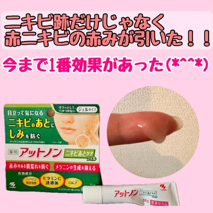 ニキビあとケアジェル/アットノン/その他スキンケアを使ったクチコミ(1枚目)