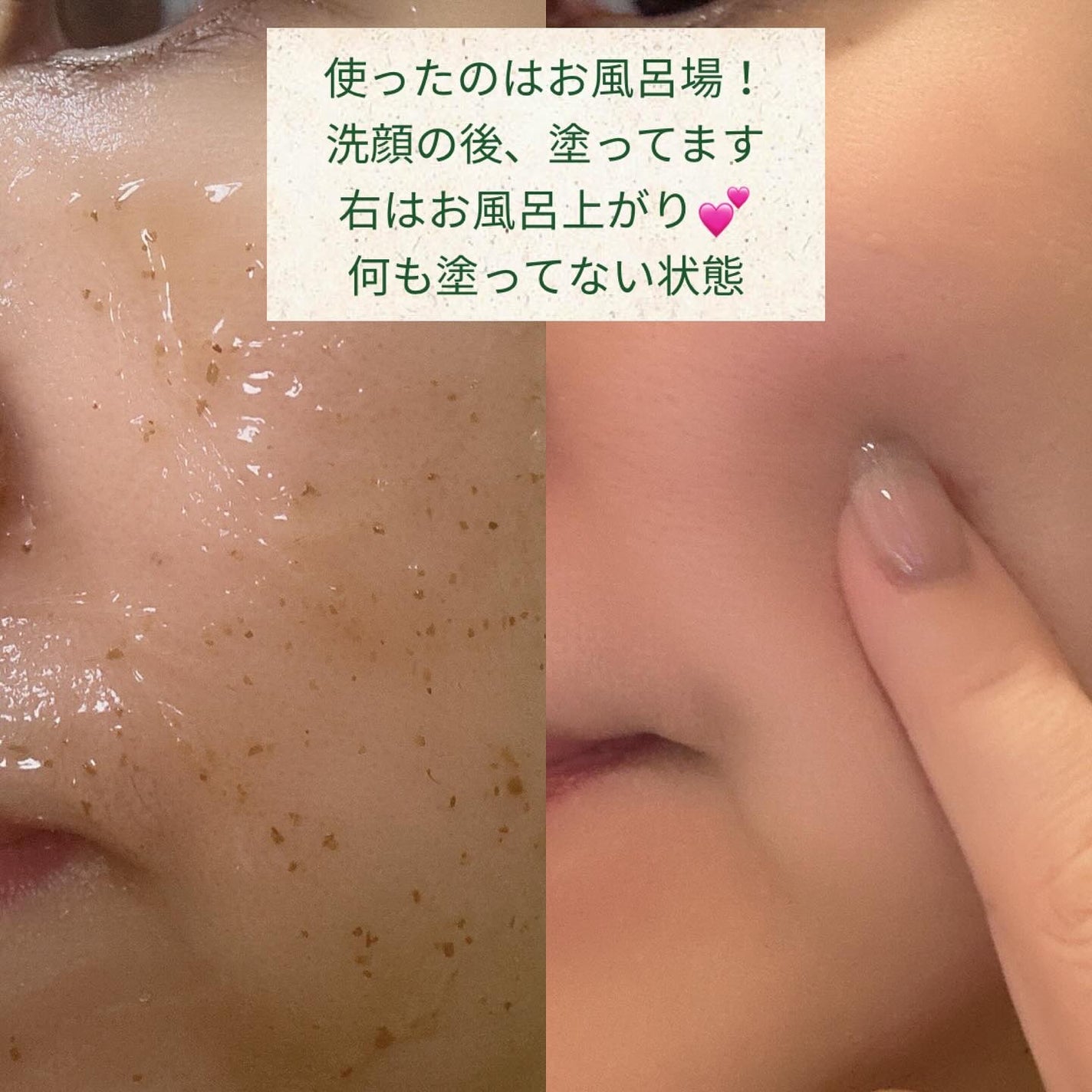 リアルシカペストパック/ビューランチ/洗い流すパック・マスクを使ったクチコミ(4枚目)