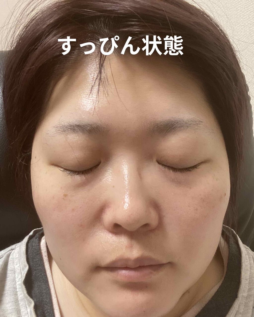 メラノフォーカスＶ/HAKU/美容液を使ったクチコミ（1枚目）