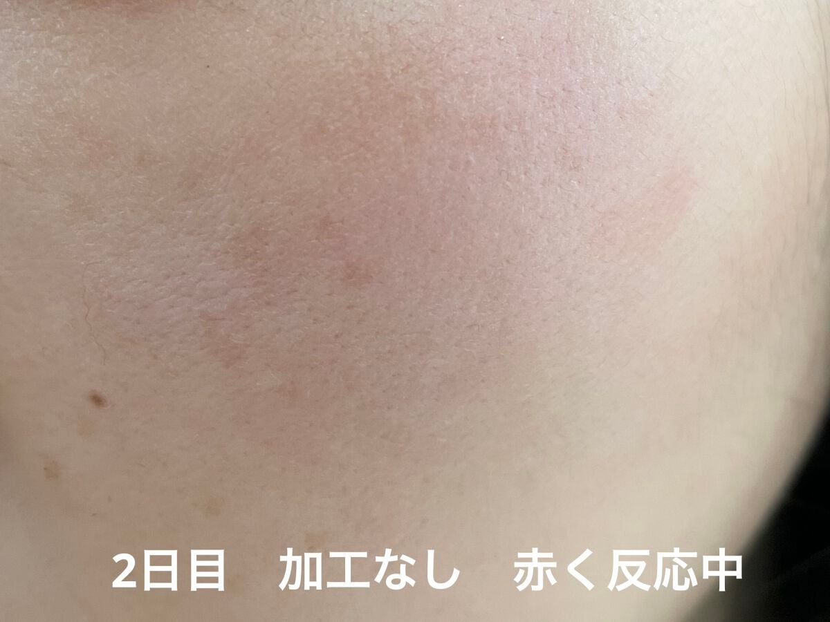 スーパーリンクルセラムVA/KISO/美容液を使ったクチコミ(4枚目)