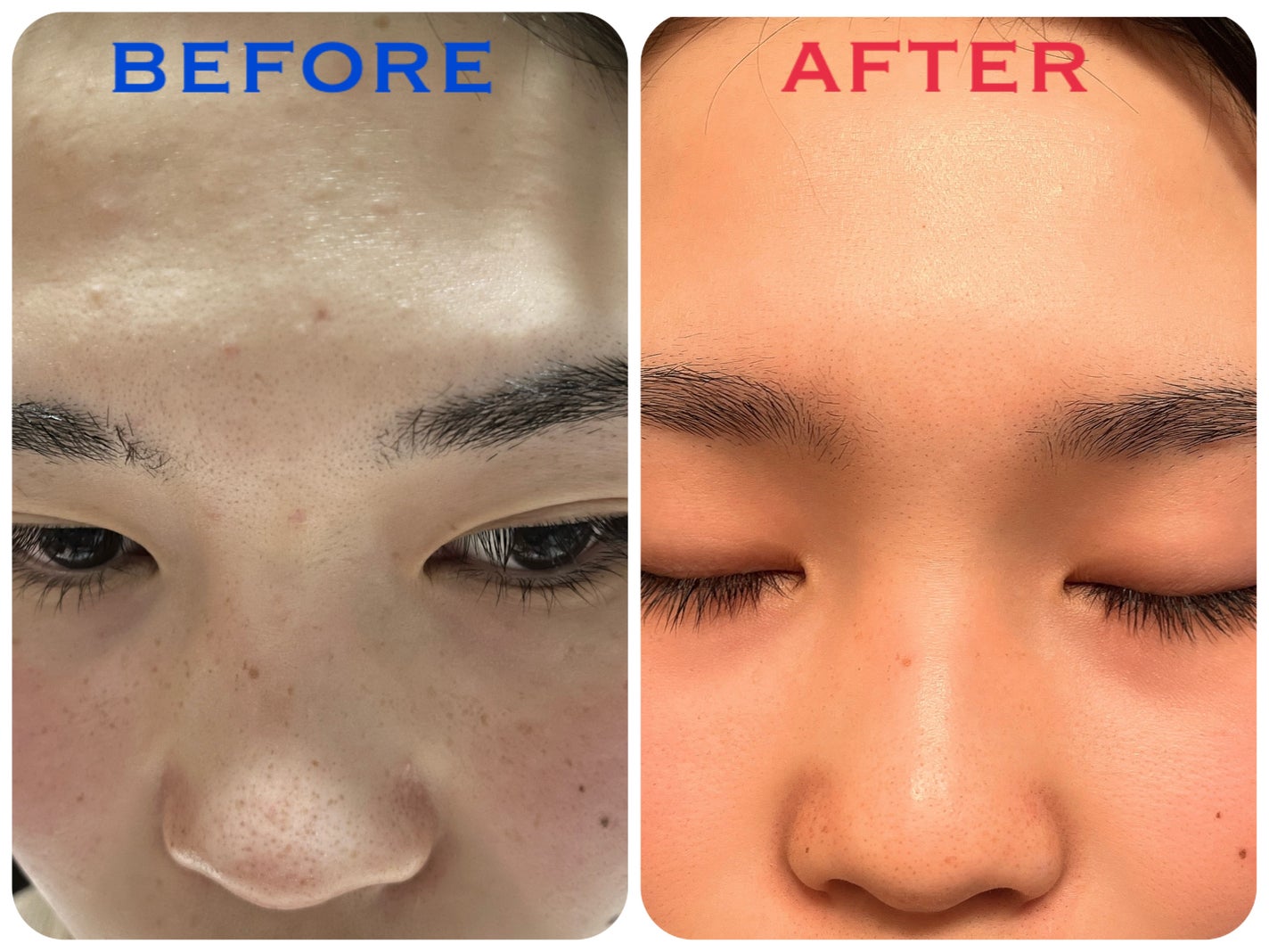 RXザ・ビタミンC23セラム/COSRX/美容液を使ったクチコミ(2枚目)