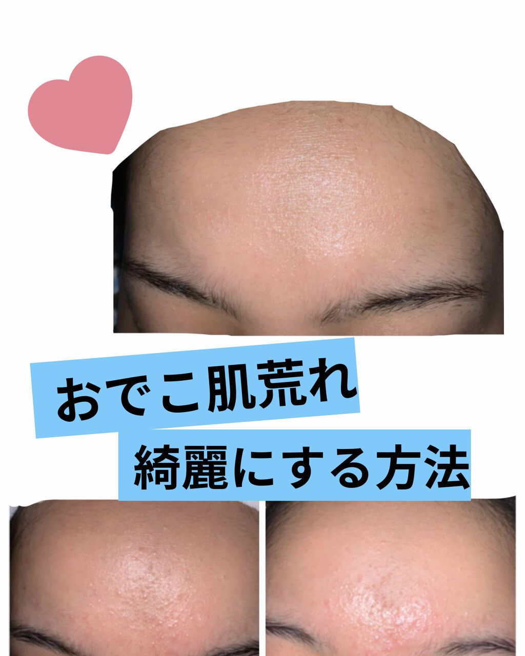 プロポリス エネルギーアンプル/CNP Laboratory/美容液を使ったクチコミ（1枚目）