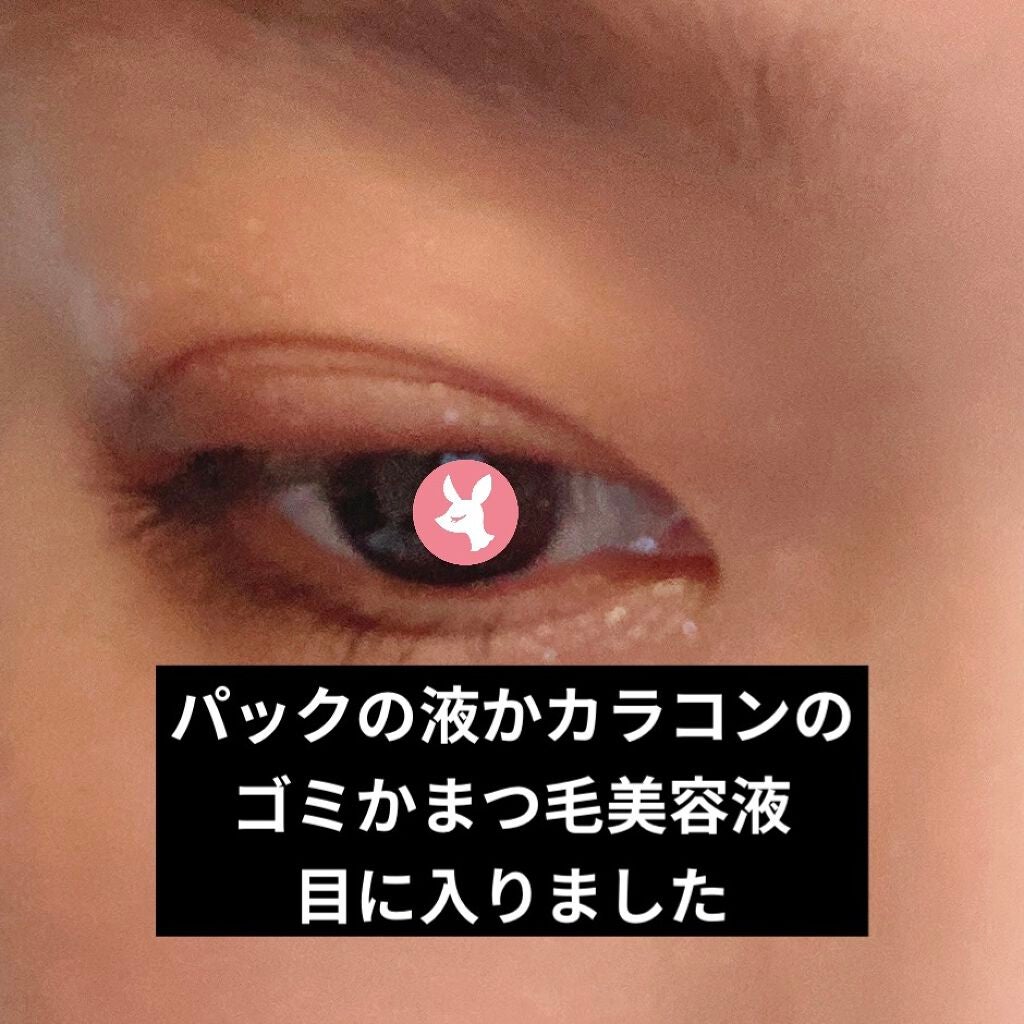 ためしたがり43歳 on LIPS 「試しすぎて全部思い当たる。コンタクトを入れた時に痛くて、ゴミだ..」(1枚目)