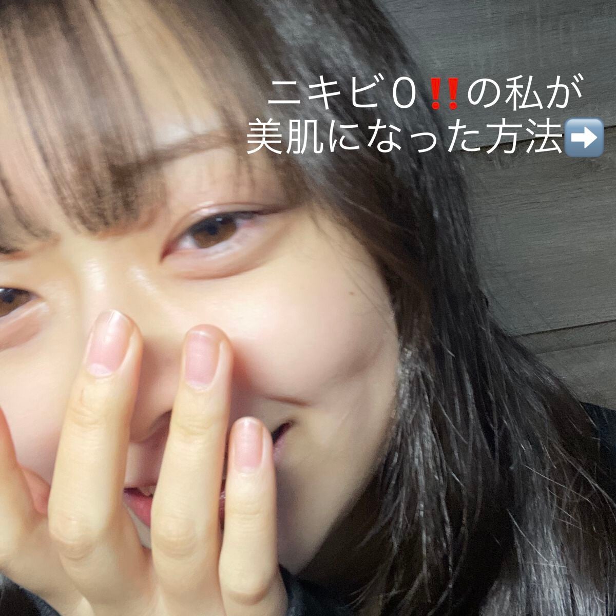 아오(ァォィ) on LIPS 「ニキビ辛くないですか?🤧私流綺麗な肌になった方法をご紹介します..」(1枚目)