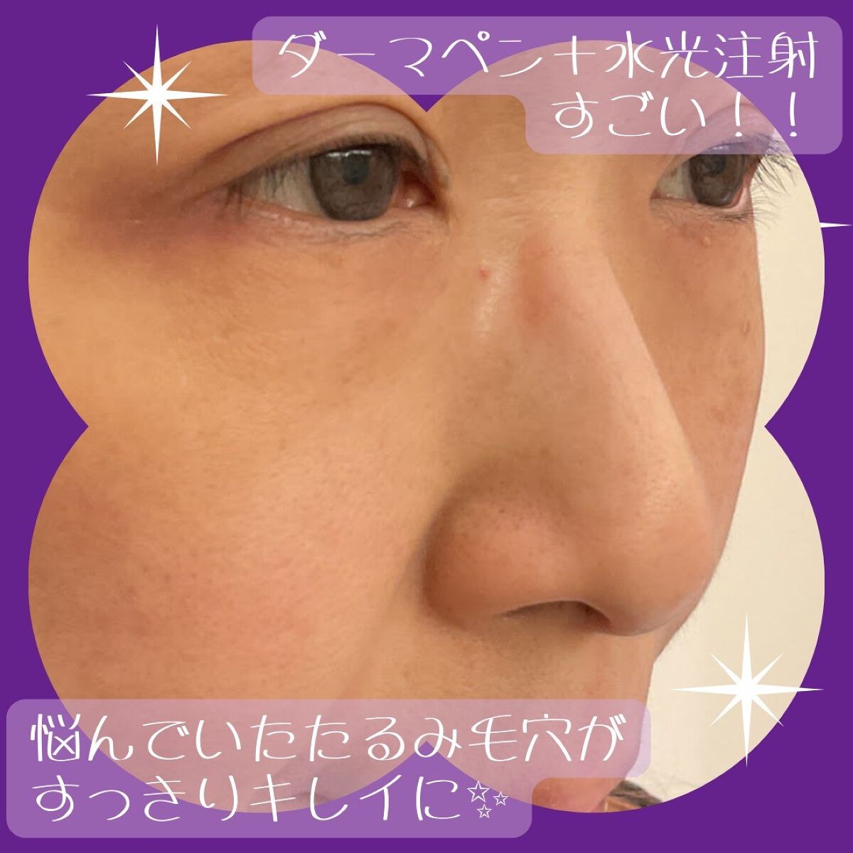 を使ったクチコミ（1枚目）