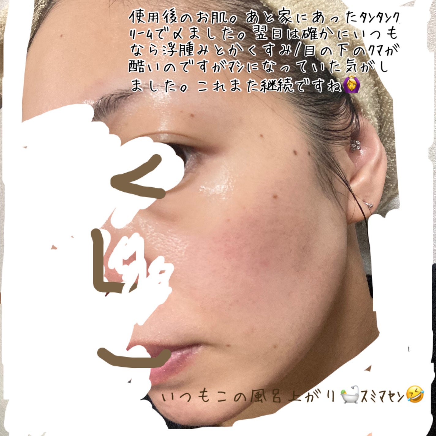 プロバイオダーム™ コラーゲン リモデリング ブースターショット プログラム/BIOHEAL BOH/美容液を使ったクチコミ(3枚目)