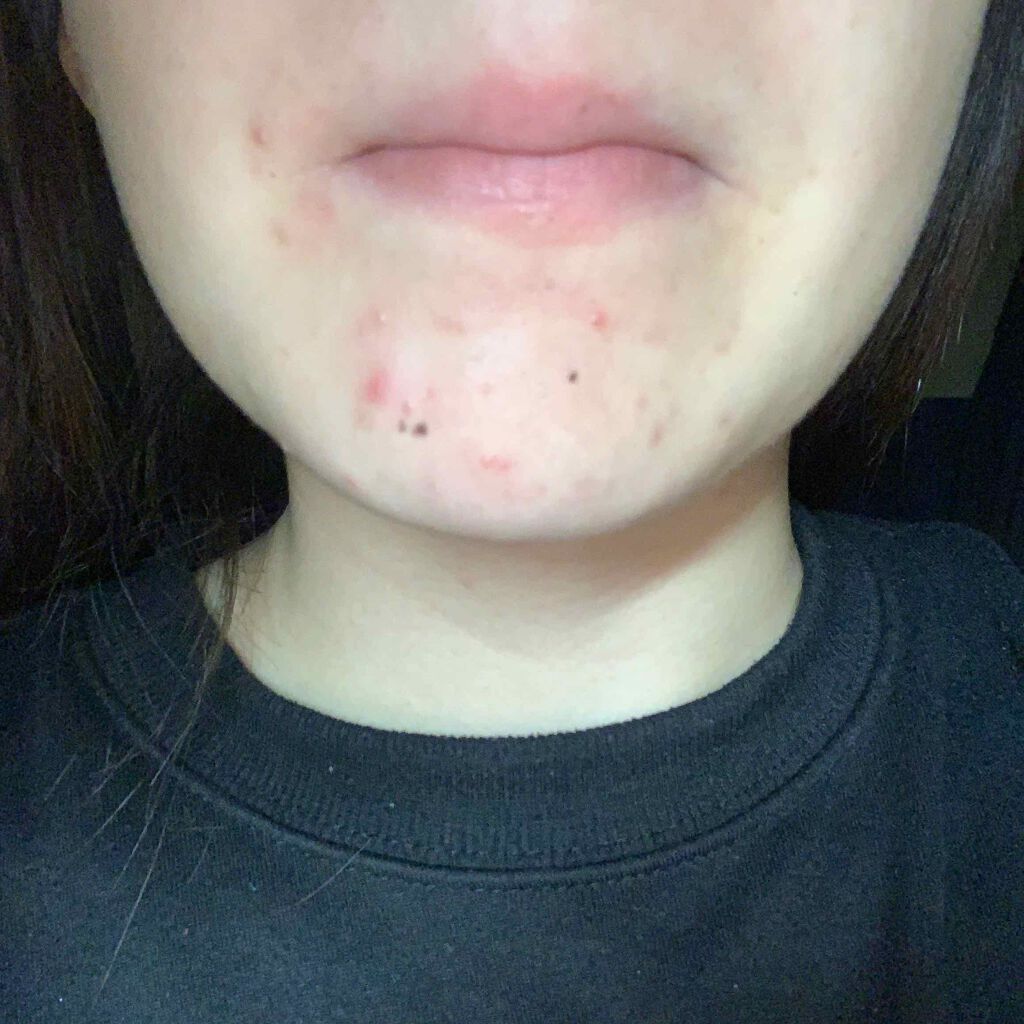 こお on LIPS 「はじめまして!!高校2年生のこおと申します!私はオイリー肌だけ..」(1枚目)