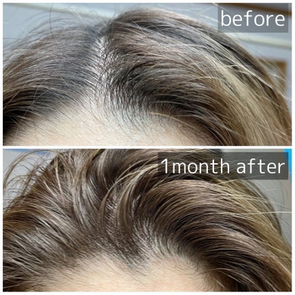 Wアプローチヘアプログラム/MUNOAGE(ミューノアージュ)/頭皮ローションを使ったクチコミ(2枚目)