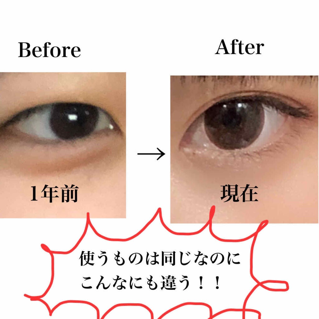 アイビューティー フィクサー WP/アストレア ヴィルゴ/二重まぶた用アイテムを使ったクチコミ(2枚目)