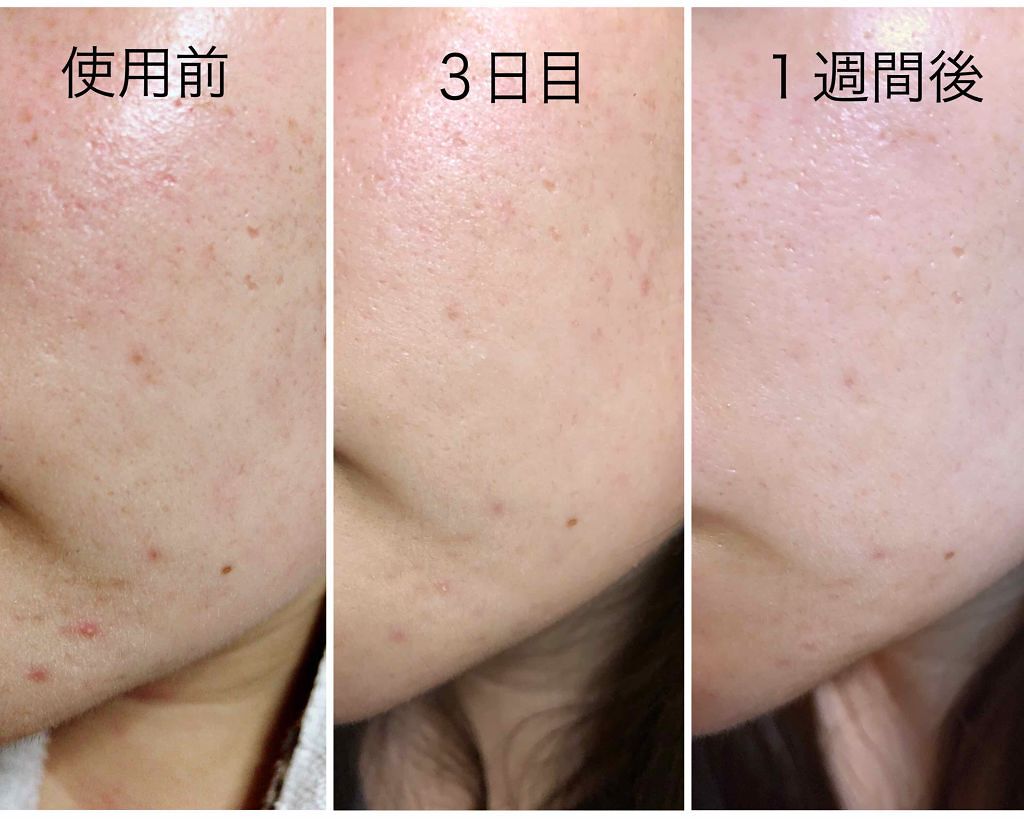 QuSomeホワイトクリーム1.9/b.glen/フェイスクリームを使ったクチコミ(1枚目)