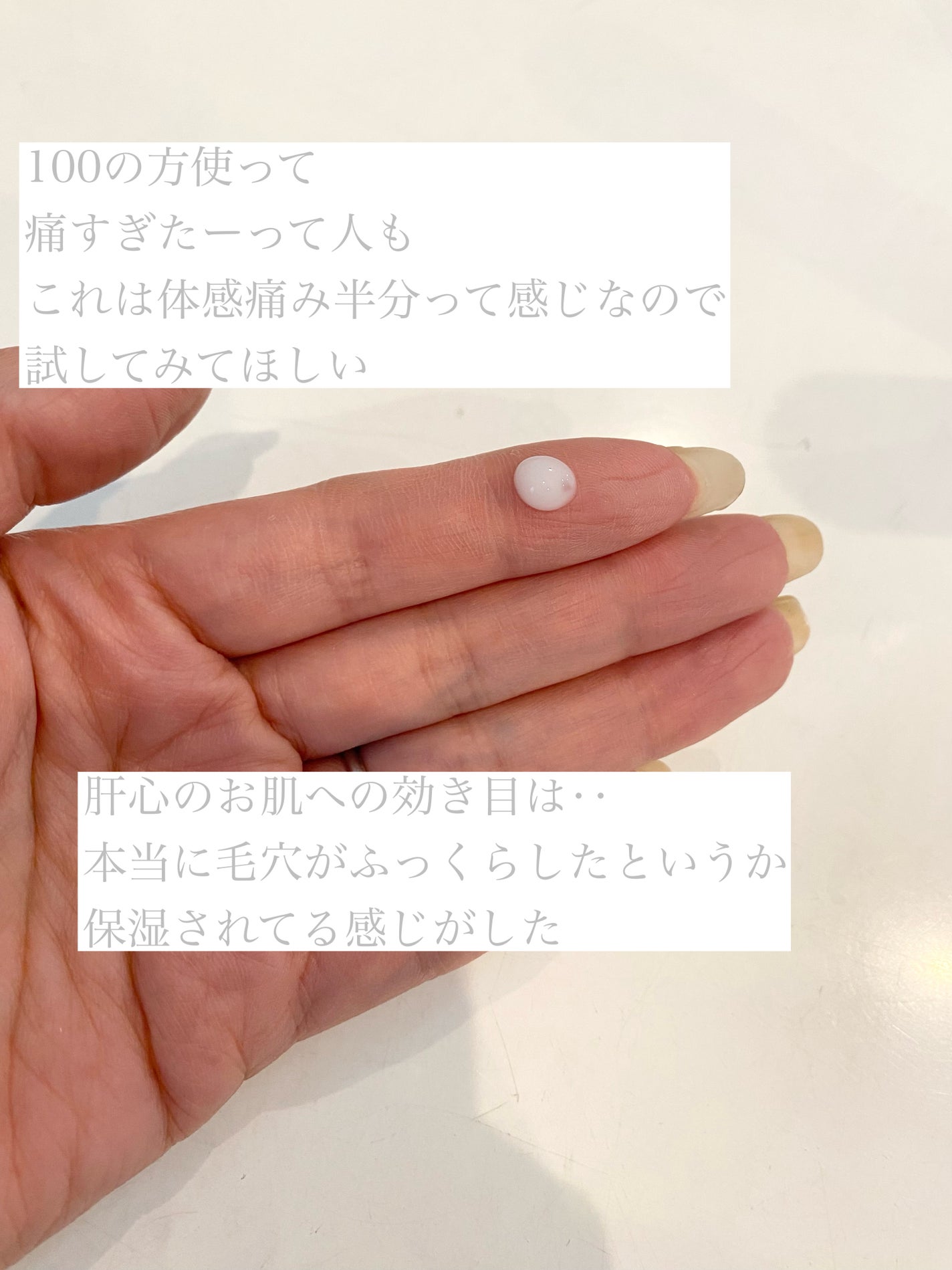 マイルドリードルショット50/VT/美容液を使ったクチコミ(3枚目)