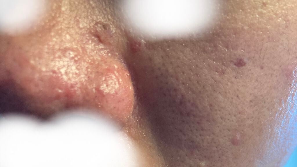 (フォロバ)3年後に韓国美男子 on LIPS 「Twitterで過大広告気味のリアラスタークレンジングの経過レ..」(3枚目)