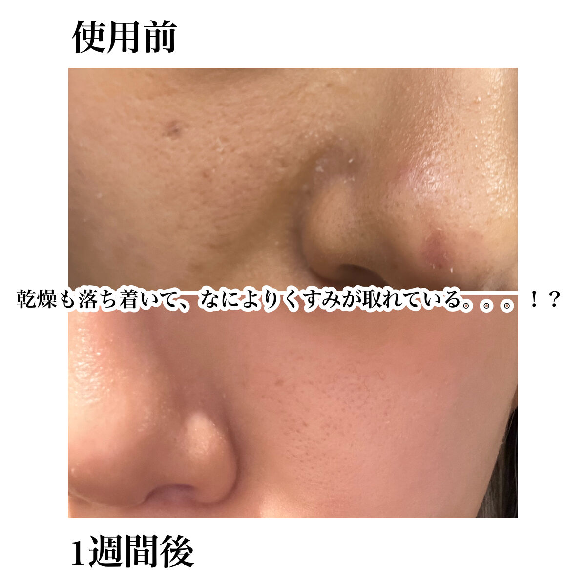 ウォッシングフォーム/シャレコ/洗顔フォームを使ったクチコミ（2枚目）