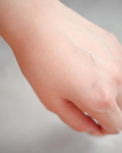 バイオイル/バイオイル/フェイスオイルを使ったクチコミ(8枚目)