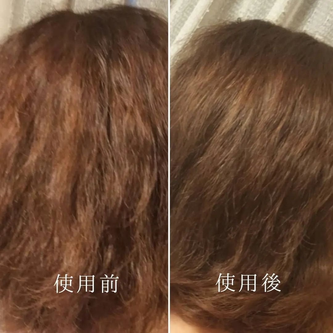 イロップ タス シャンプー/トリートメント/irop/市販シャンプーを使ったクチコミ(7枚目)