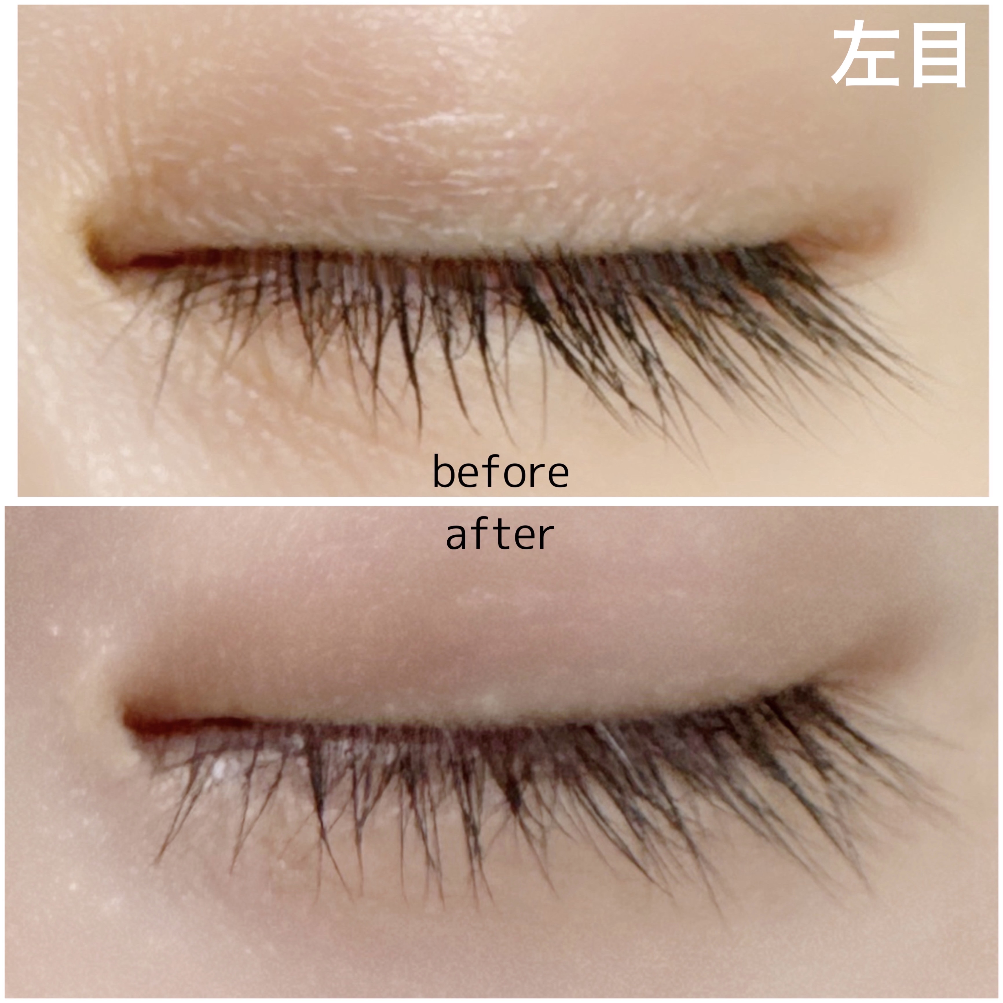 湘南美容まつ毛美容液/Co-medical+/まつげ美容液を使ったクチコミ（2枚目）