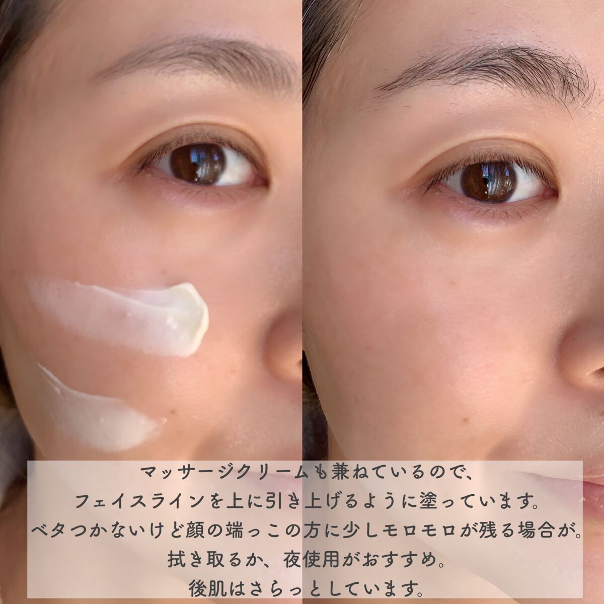 スージング アルニカクリーム/ARGITAL/フェイスクリームを使ったクチコミ(3枚目)