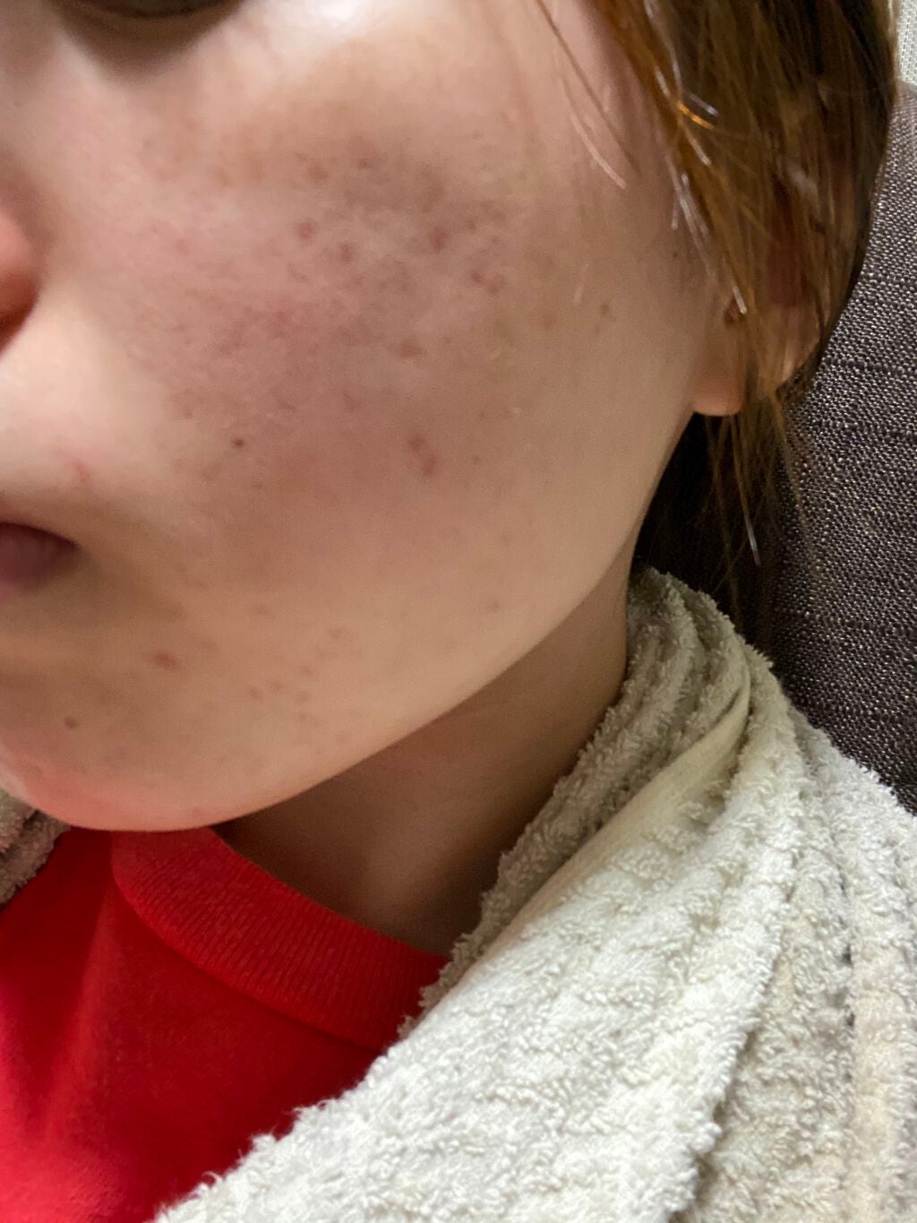 メディカルクリームG(薬用クリームG)/メンターム/ハンドクリームを使ったクチコミ(4枚目)