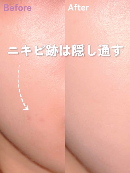 &be ファンシーラー ベージュ&オレンジ/&be/パレットコンシーラーを使ったクチコミ(1枚目)