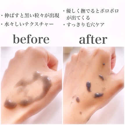 DETクリア ブライト&ピール ピーリングジェリー<炭タイプ>/Detclear/ピーリングを使ったクチコミ(3枚目)