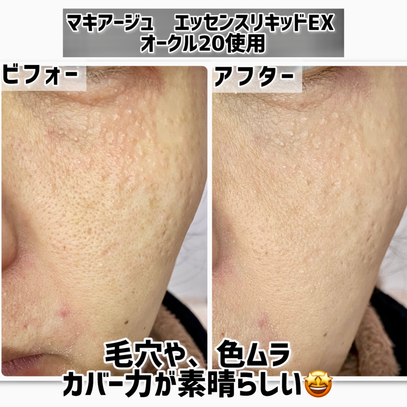 エッセンスリキッド EX/マキアージュ/リキッドファンデーションを使ったクチコミ(5枚目)