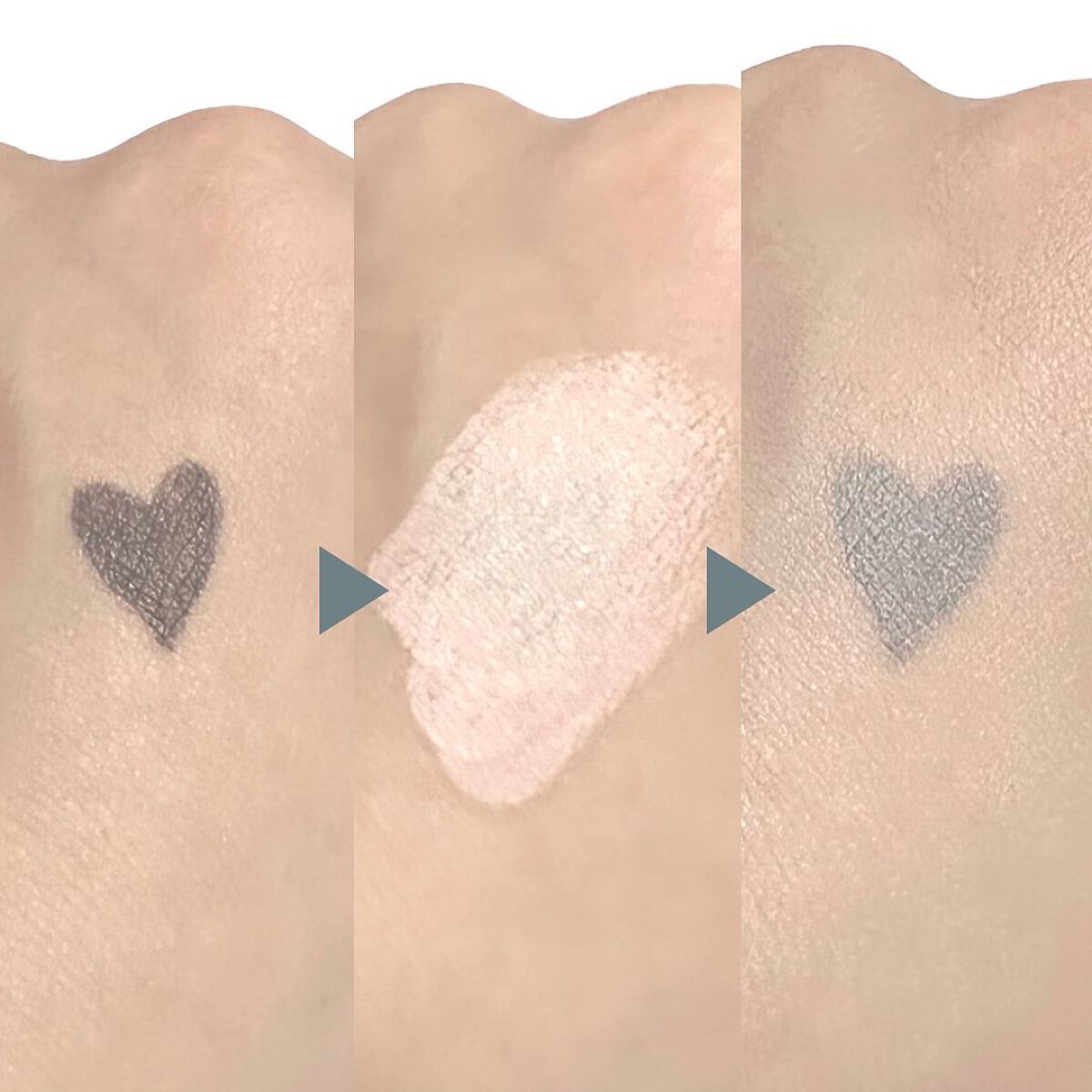 湘南美容コンシーラー/湘南美容/スティックコンシーラーを使ったクチコミ(5枚目)