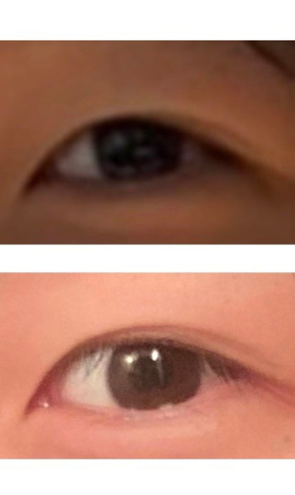 けろんちょ on LIPS 「【激重奥二重さん用アイプチ術🦋】こんにちは🌞激重奥二重ちゃんで..」(5枚目)