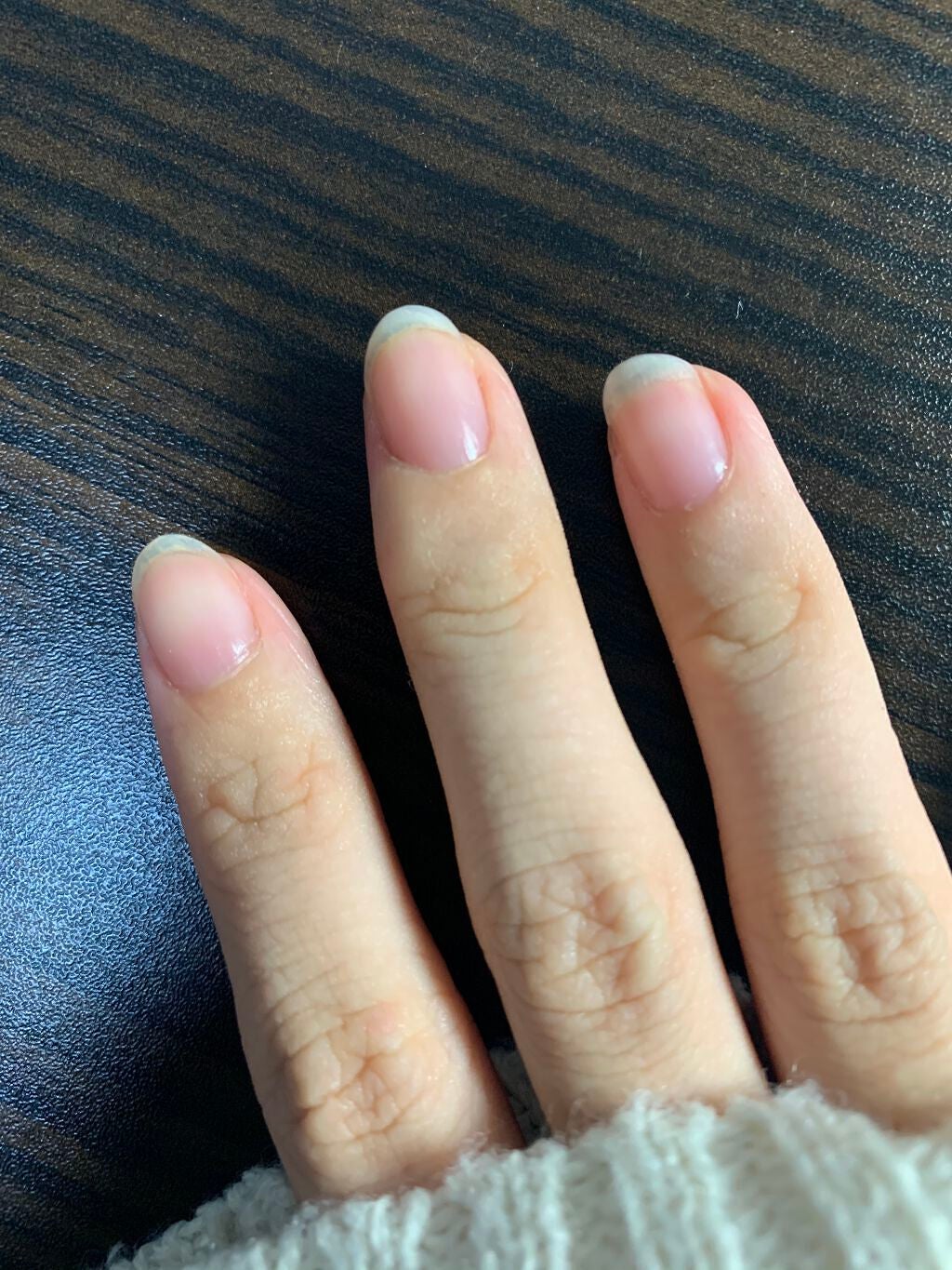 ネイルベッドオイル/アンドネイル/ネイルオイル・トリートメントを使ったクチコミ(4枚目)
