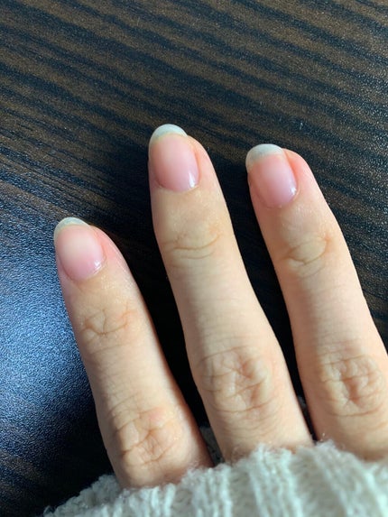 ネイルベッドオイル/アンドネイル/ネイルオイル・トリートメントを使ったクチコミ(4枚目)