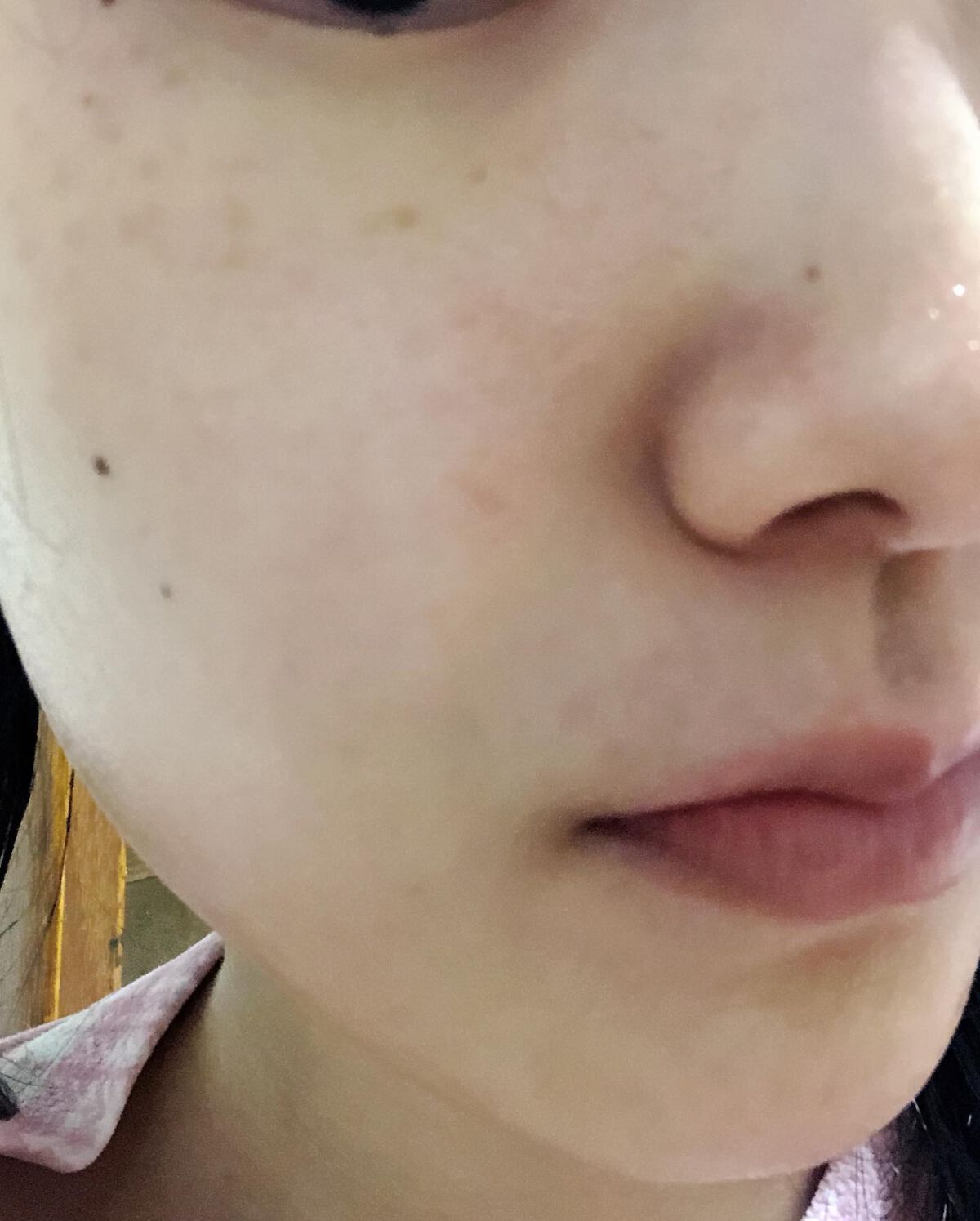 アカルミー化粧水/ワイズ/化粧水を使ったクチコミ（3枚目）