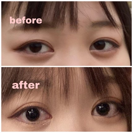 オリシキ アイリッドスキンフィルム /D-UP/二重まぶた用アイテムを使ったクチコミ(1枚目)