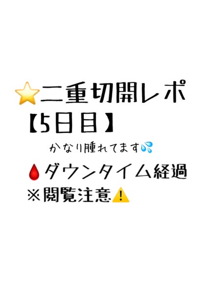 ã䜿ã£ãã¯ãã³ãïŒ1æç®ïŒ