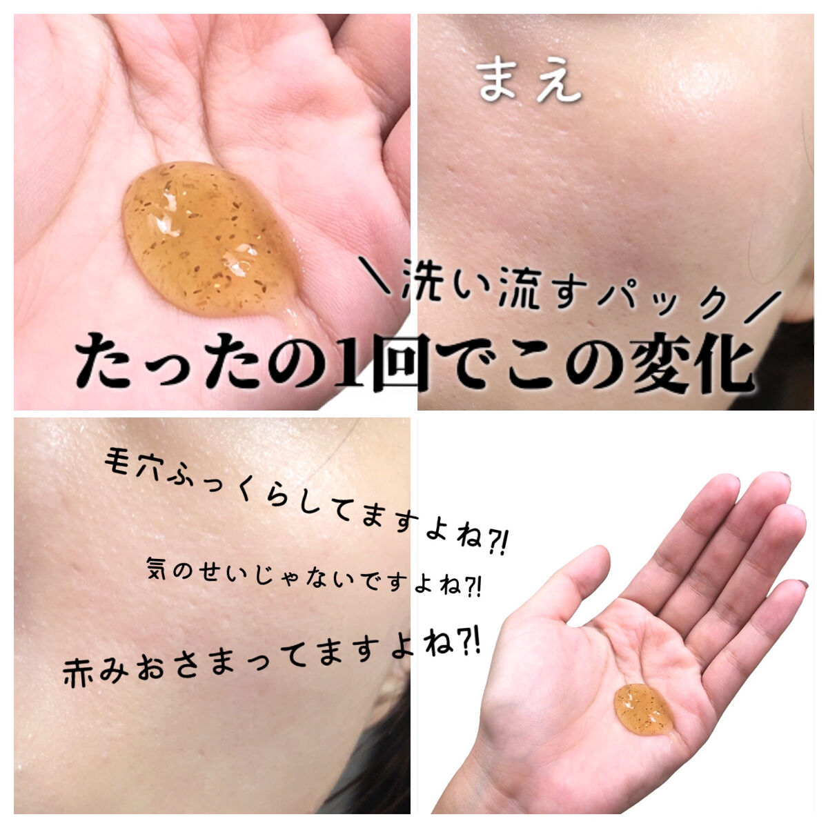 リリーフカモミールマスク/HYGGEE/洗い流すパック・マスクを使ったクチコミ（1枚目）