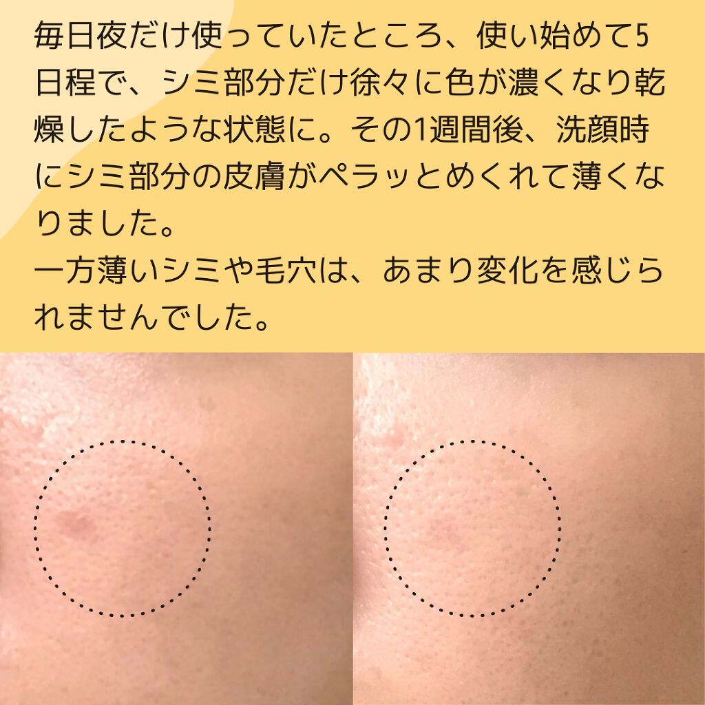 スーパーリンクルセラムVA/KISO/美容液を使ったクチコミ(3枚目)