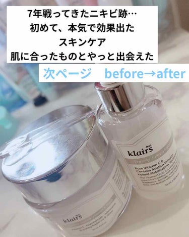 Klairs フレッシュリージュースドビタミンドロップ(35ml)のクチコミ「
初めて、ニキビ跡薄くなったかもと思ったスキンケア

フラクショナルレーザー打って
痛いしDT.....」（1枚目）