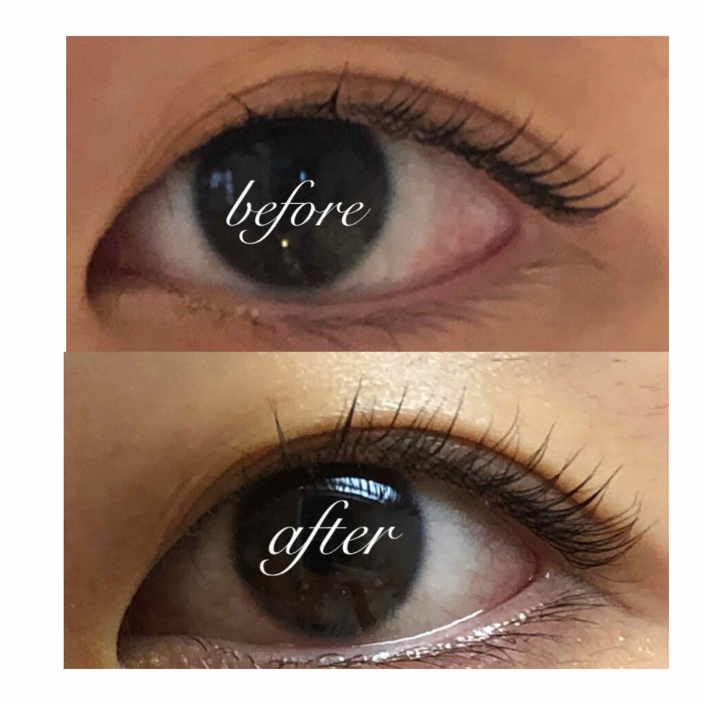 ð¿yuzuhað¿ on LIPS ããã®ãŸã€ãçŸå®¹æ¶²æšããŸã!!!ç§ã®éã£ãŠããè±æ¯ãµãã³ã«çœ®ããŠ..ãïŒ3æç®ïŒ