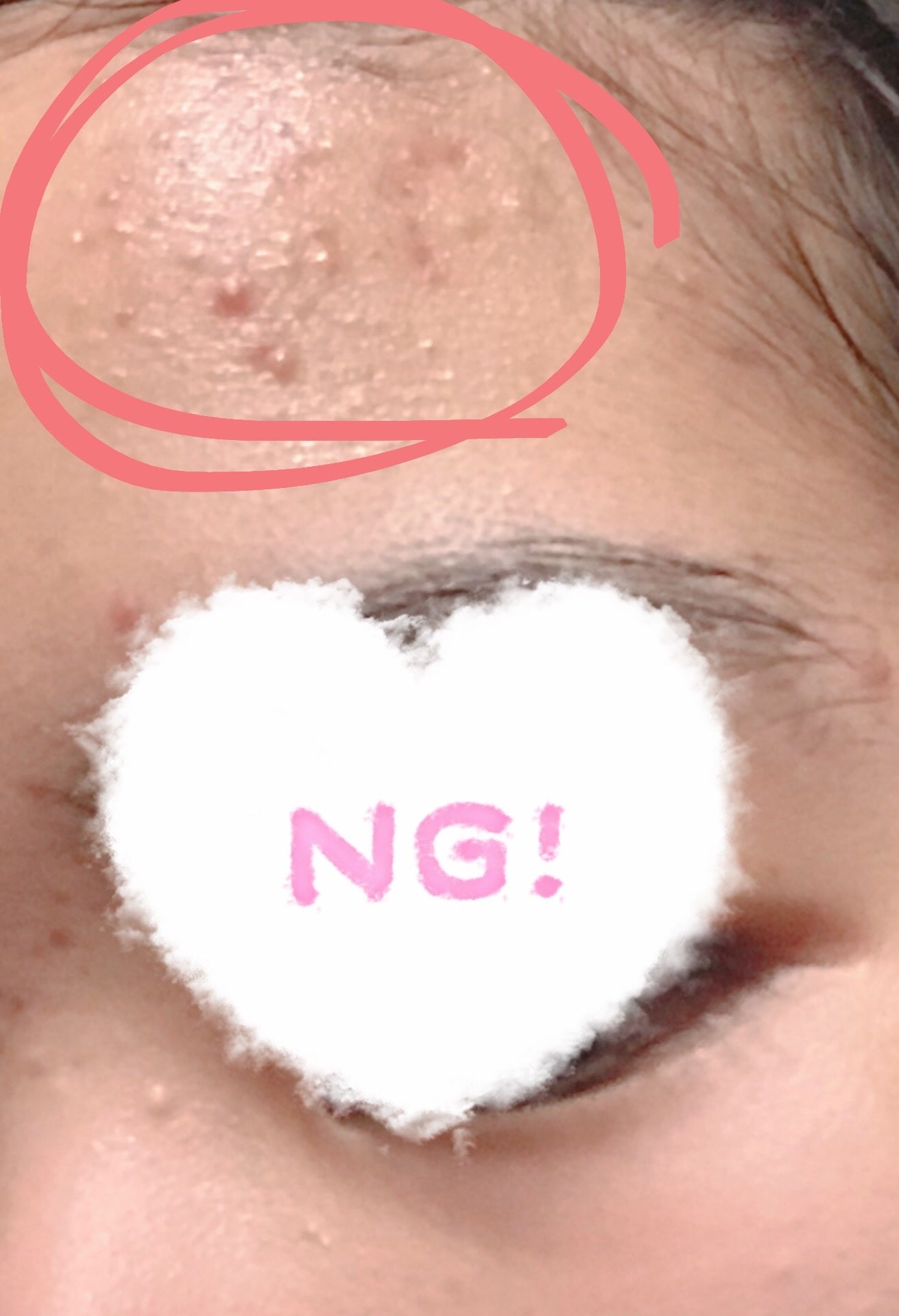 lui on LIPS 「#肌荒れ_ニキビ#ニキビ肌#混合肌_ニキビ絶賛肌荒れ中の高校一..」(3枚目)